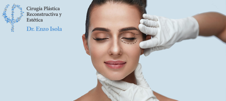 Blefaroplastia post operatoria