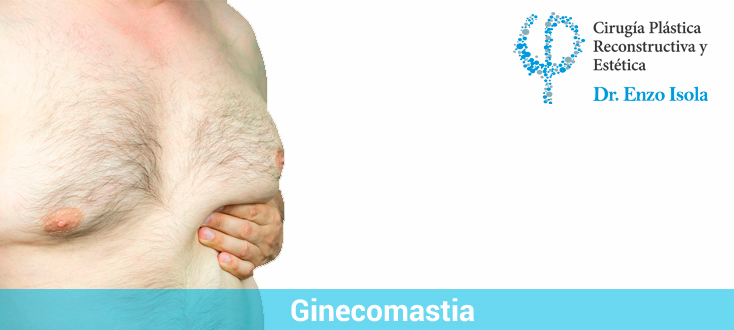 ginecomastia en Salta