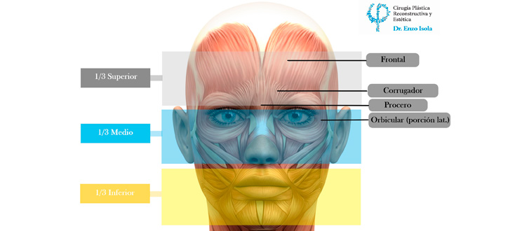 Arrugas de expresión - División del rostro