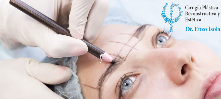 Cilioplastia - Preparación pre-operatoria