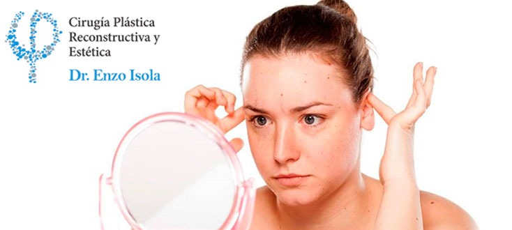 Cirugía Estética de cabeza y cuello: Orejas