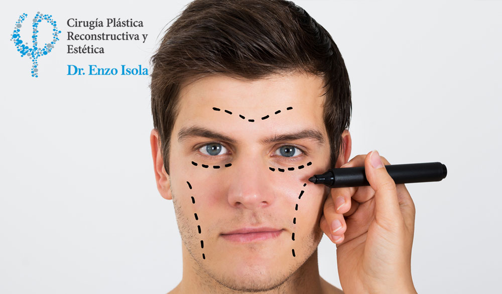 Cirugía Estética de Hombres