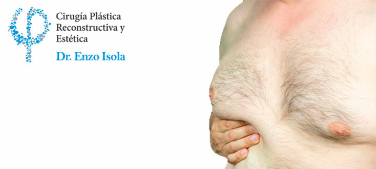 Cirugía Estética Mamaria: Ginecomastía (Hombres)