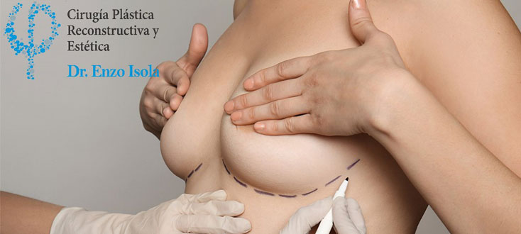 Reducción mamaria - Preparación pre-operatoria