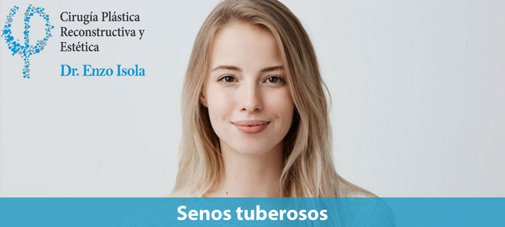 Senos tuberosos