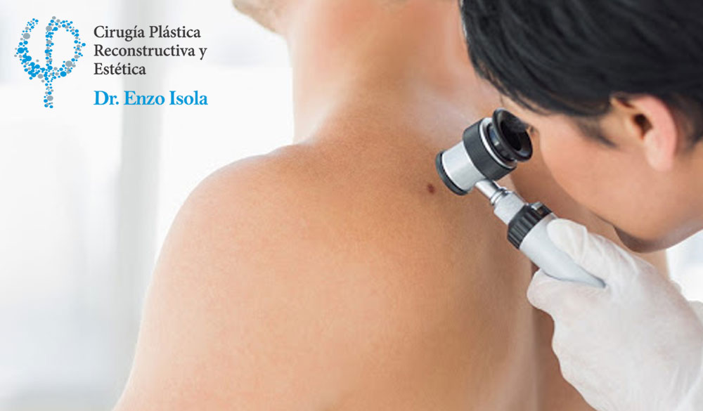 Cirugía Reconstructiva por Lesiones Cutáneas