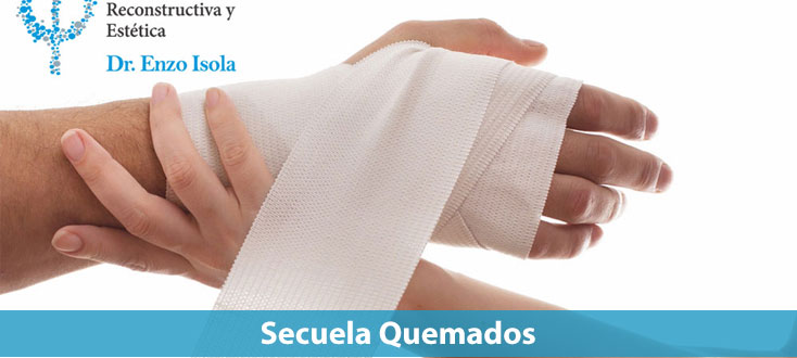 Secuela quemados