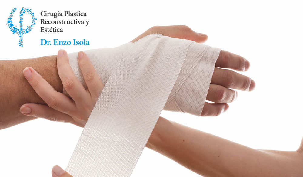 Cirugía Reconstructiva por Secuela de quemados