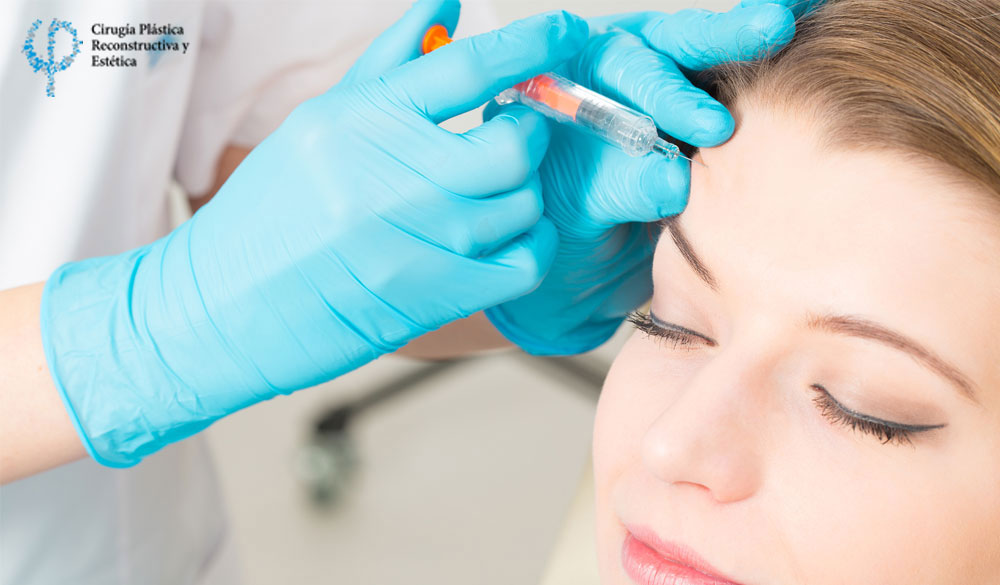 Procedimientos No Quirúrgicos de Arrugas de expresión